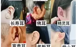 常见的几种植耳型